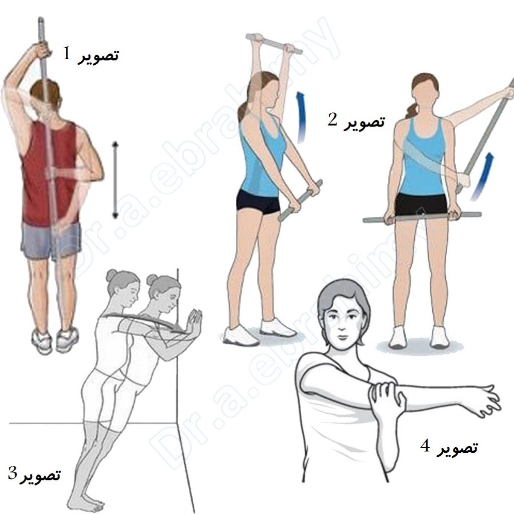 ورزش برای رفع محدودیت حرکت مفصل شانه